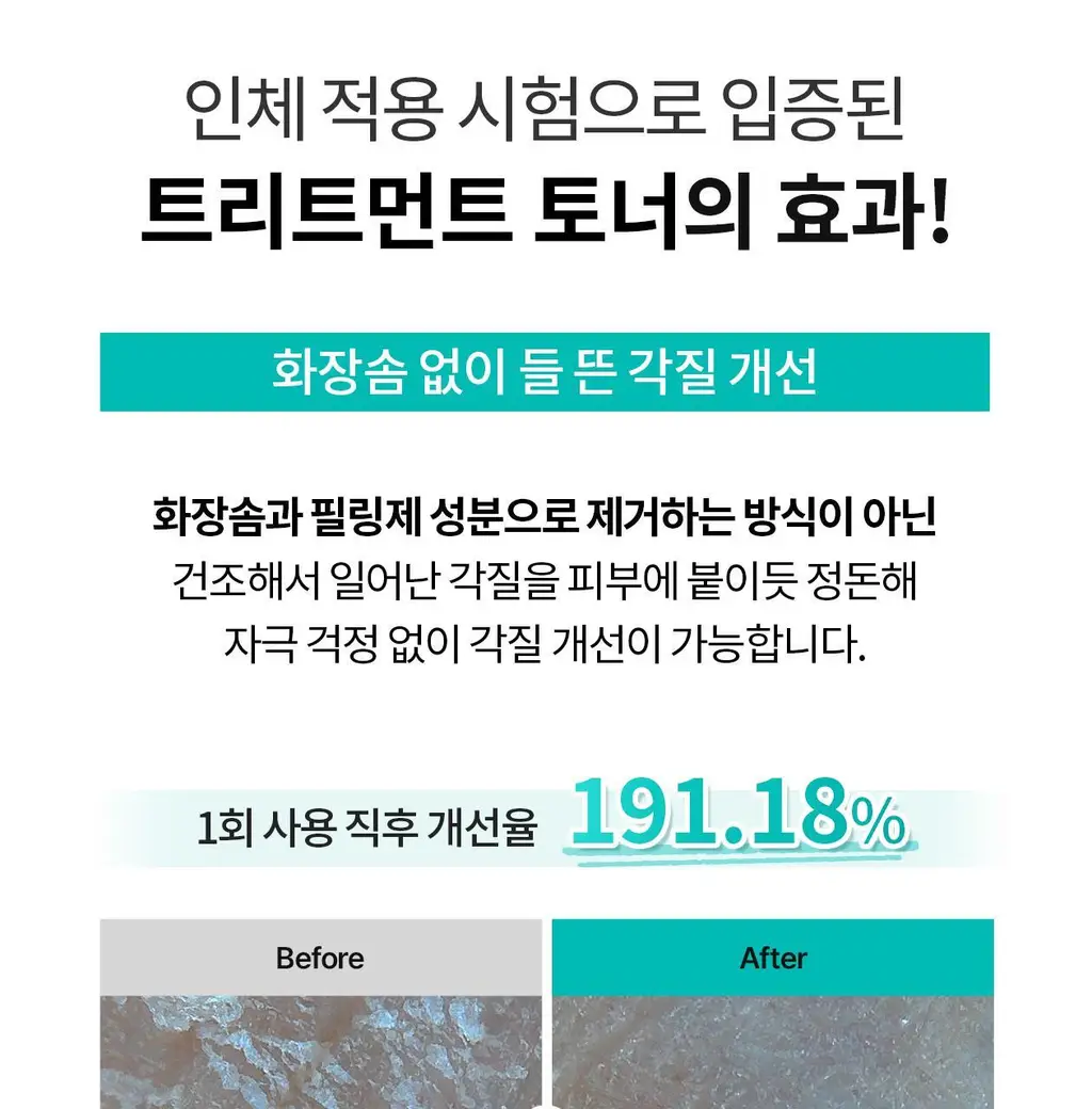 [각질개선율191%]리쥬란 더마 힐러 모이스처 트리트먼트 토너 150ml 상세페이지 13